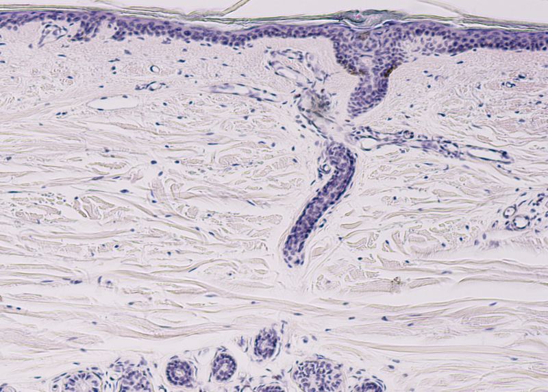 Human skin and sweat gland