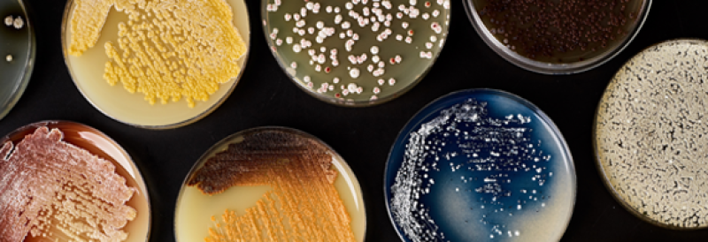 A multi-color collection of petri dishes with bacteria growing on them.