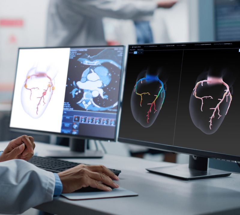 HeartFlow’s AI-powered medical technology debuts on Nasdaq | NSF