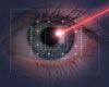 laser going into an eye