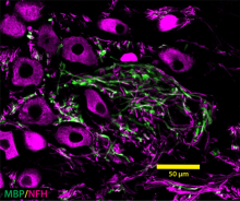 AxoSim's 3D NerveSim platform