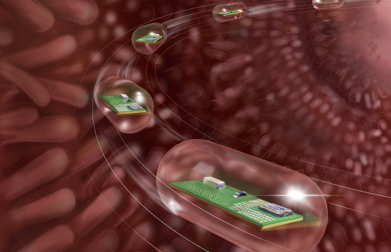 Smart-pills to help diagnose gut disorders