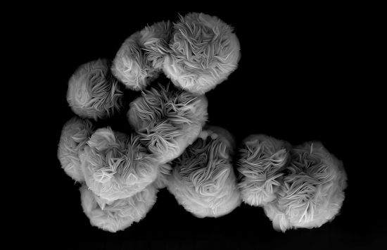 Microscopic image of human-made finely layered spherical objects.