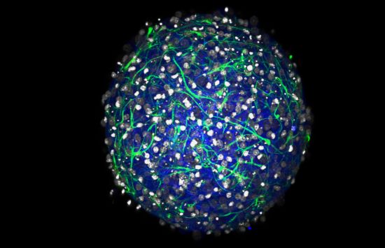 A glowing sphere of neurons