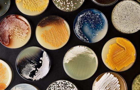 A series of petri dishes containing a variety of colorful bacterial growths against a black background.
