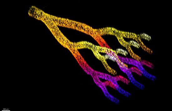 tissue engineering of blood vessels and lymphatic vessels, tissue engineering of blood vessels and lymphatic vessels