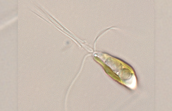 A light microscopy