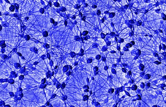 A dense network of bright blue threads connecting blue blobs.