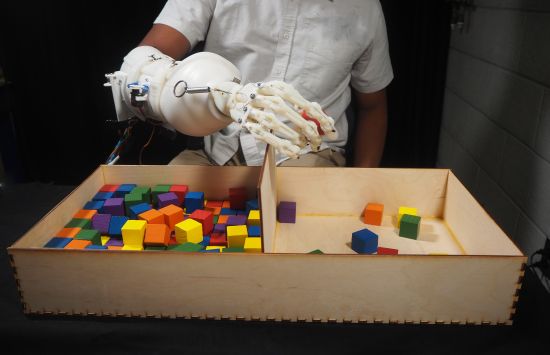 Wearable anthropomorphically driven prosthesis with built in haptic feedback system playing with colorful blocks