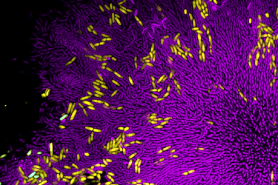 bacterium.png?itok=5bVuCsu7