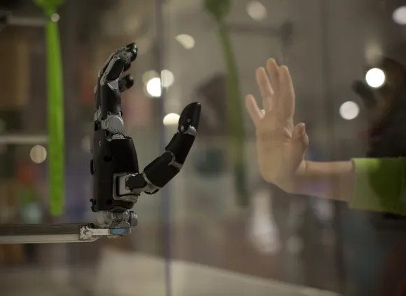 Prosthetic arm