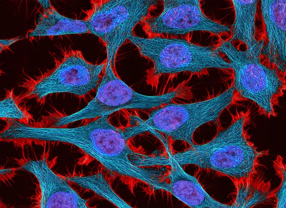 A highly magnified view of about a dozen cells, whose nuclei are clearly visible.