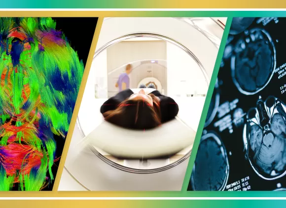 A composite image. Left image is a colorful MRI imagine of a mouse brain. Center image of a woman laying down inside of an MRI machine. Right image is a collection of images of an MRI brain scan.
