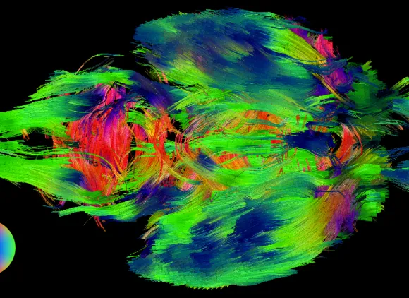 The shape of a mouse brain filled with brightly colored lines and smudges on a black background.