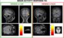 brain xrays