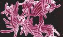 Mycobacterium