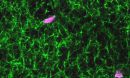 A microscopic image of a blood clot containing synthetic platelet-like-particles. Fibrin is shown in green and the synthetic platelets are pink.