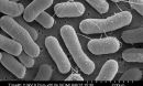 micrograph showing methane-eating bacteria