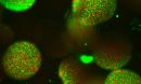 different species of bacteria