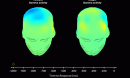image showing insight-related brain activity