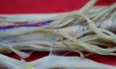 spinal cord