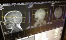scans of infants' brains