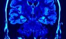 A real scan of a human brain.