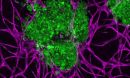 3D bioprinted breast cancer tumors (green)