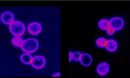 Aneuploid yeast cells