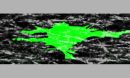 Scientists are discovering clues to a mystery about cell movement.