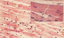heart cells