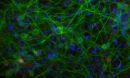 Hippocampus cells