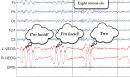 a recording of electrical signals from a sleeping participant's mind and eyes