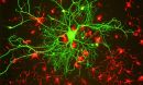 cortical neuron stained with antibody to neurofilament subunit NF-L in green