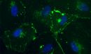 an image of primary human amniotic fluid stem cells in a culture dish