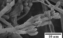 A scanning electron micrograph of fungus Nodulisporium sp.