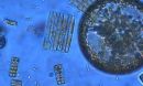 A mosaic of phytoplankton species from the Southern Ocean.