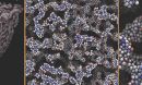 colloidal gel structure