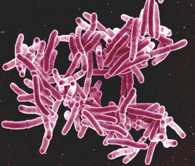 Mycobacterium