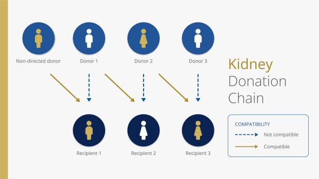 A diagram where a non-directed donor donates a kidney to a recipient whose initial donor was incompatible. The incompatible donor donates to a second recipient, and so on.