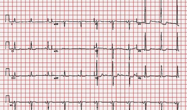 vitals on graph