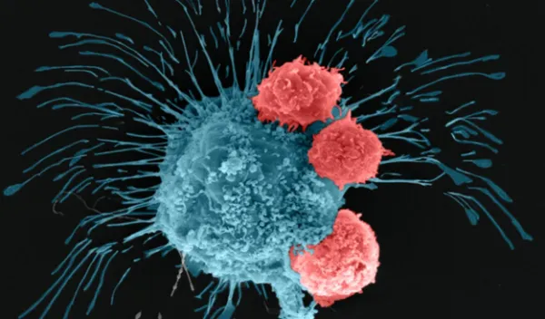 cancer cells under a microscope