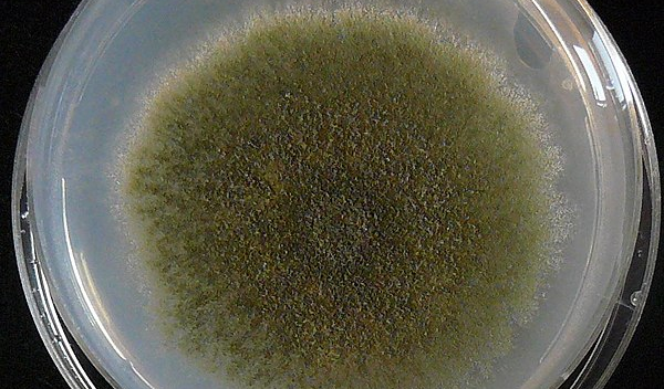 petri dish with sample in it