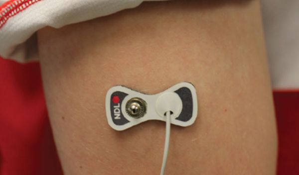A prototype of a device that can measure interstitial fluid uses microneedles.