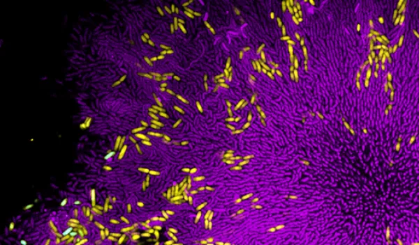 microscopic view of bacteria