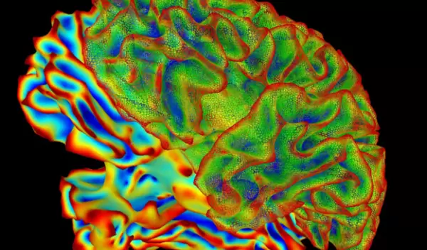 xray of brain