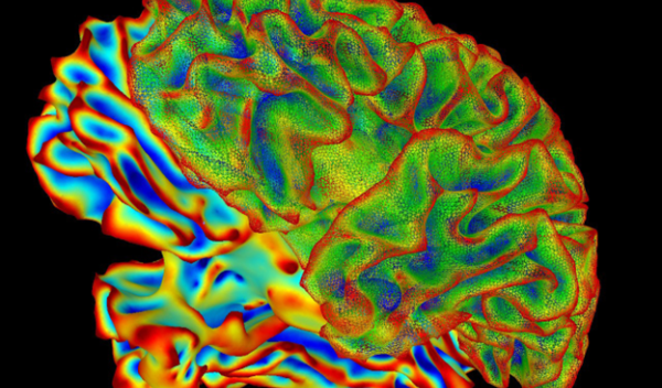 xray of brain