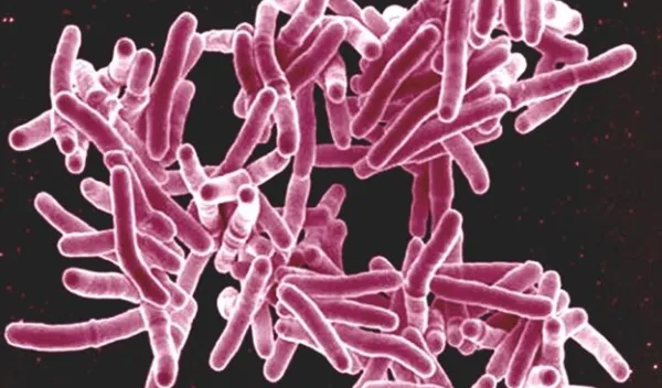 Mycobacterium