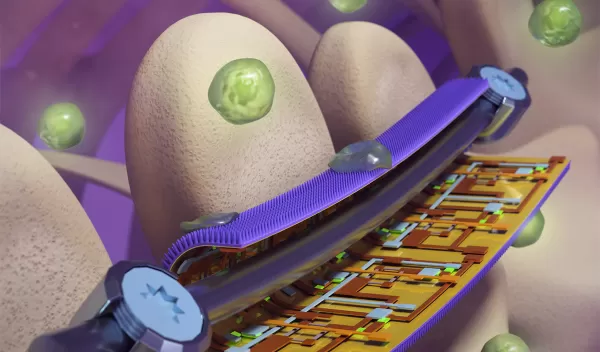 Illustration of "smart" coating, developed for surgical orthopedic implants