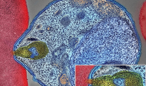 Colorized electron micrograph showing malaria parasite (right, blue) attaching to a human red blood cell.